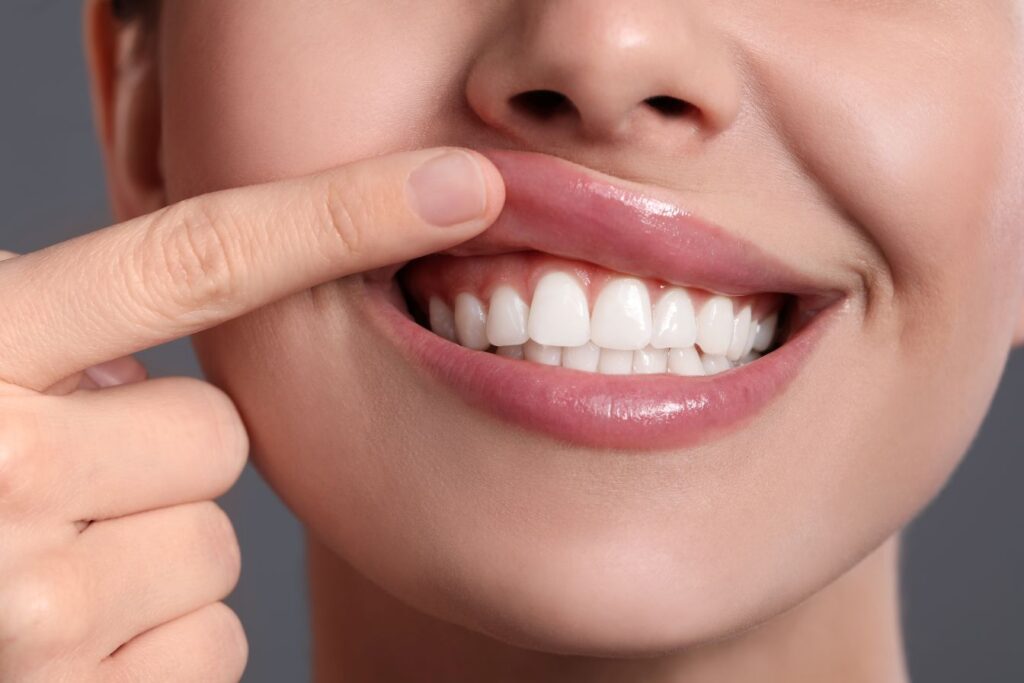 A woman showing her gums